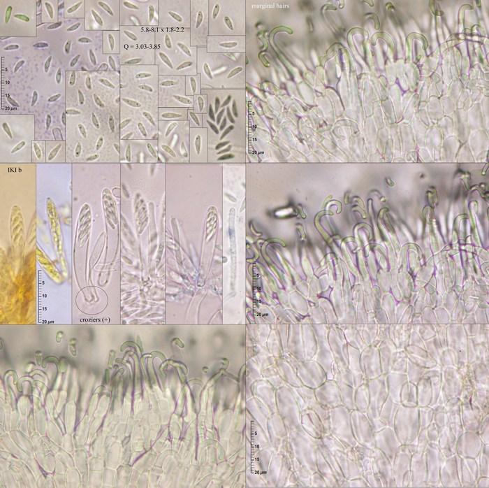 macrostoma