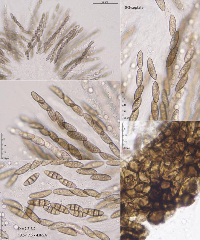macrostoma