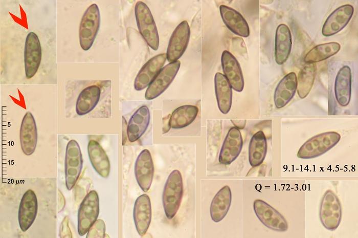 macrostoma
