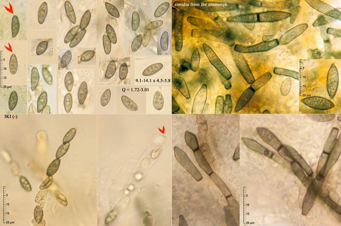 macrostoma