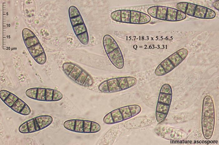 macrostoma