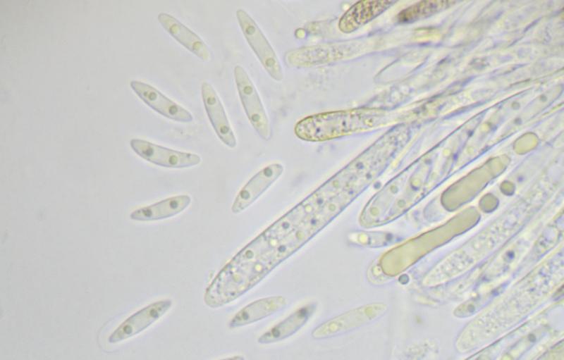 macrostoma