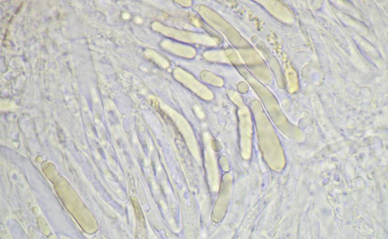 macrostoma