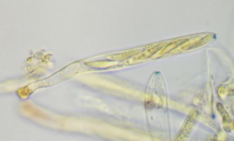macrostoma