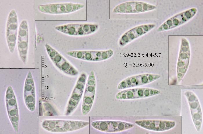 macrostoma