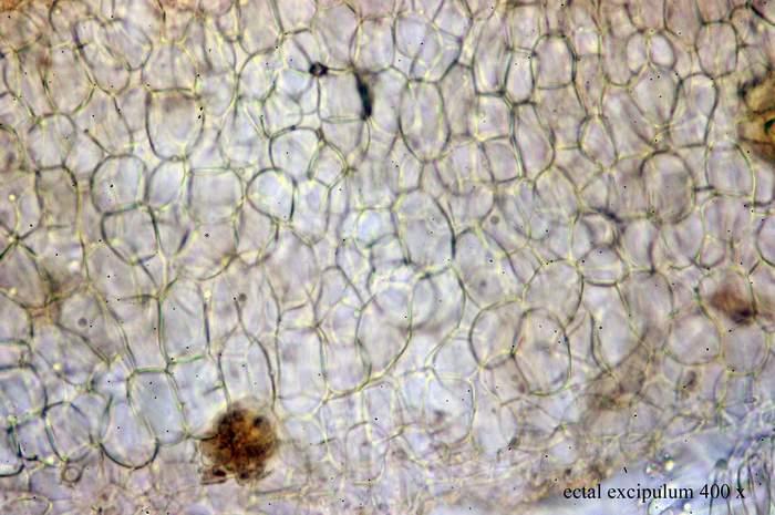 macrostoma