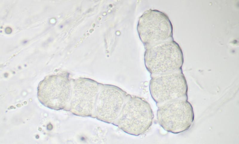macrostoma