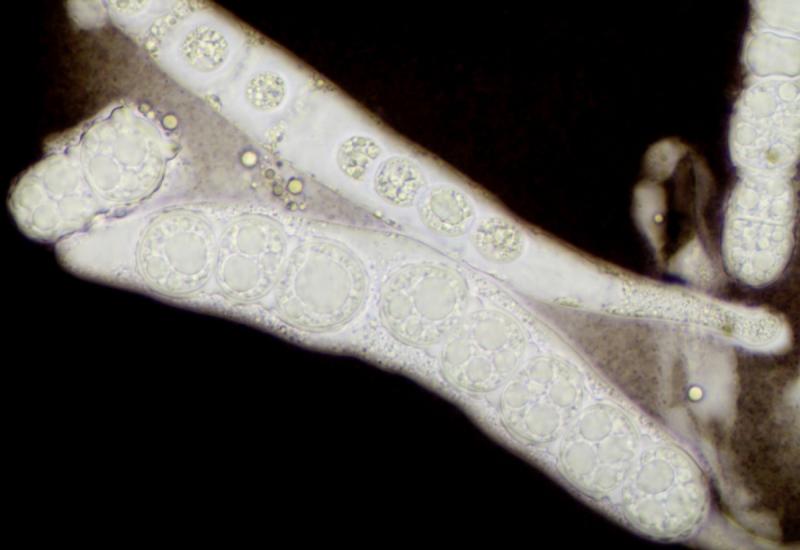 macrostoma