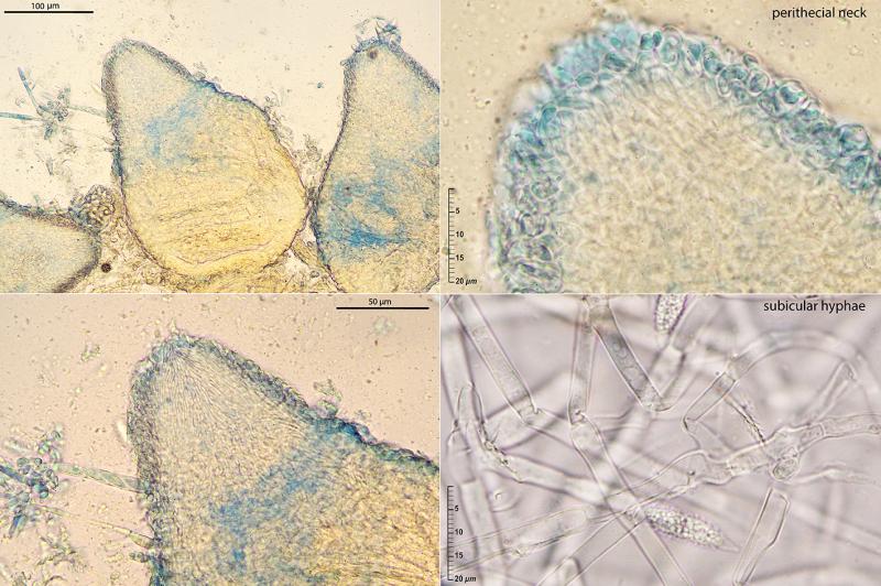 macrostoma