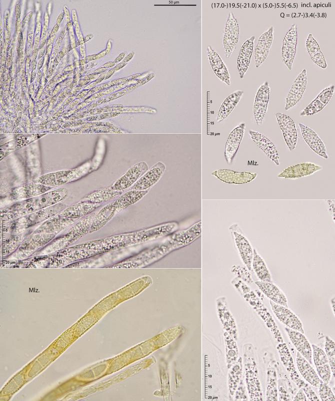 macrostoma