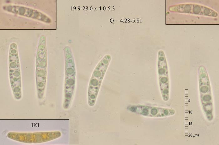 macrostoma