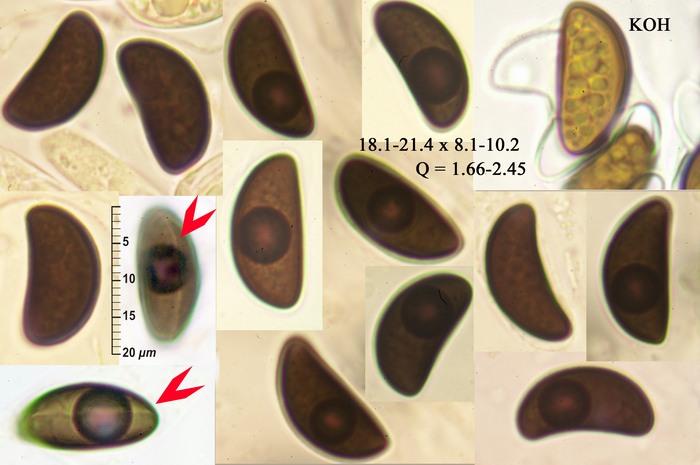 macrostoma