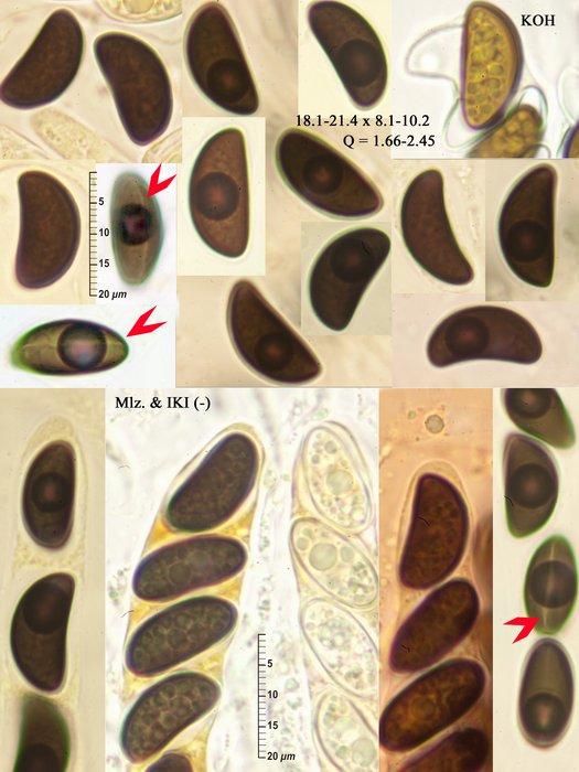 macrostoma
