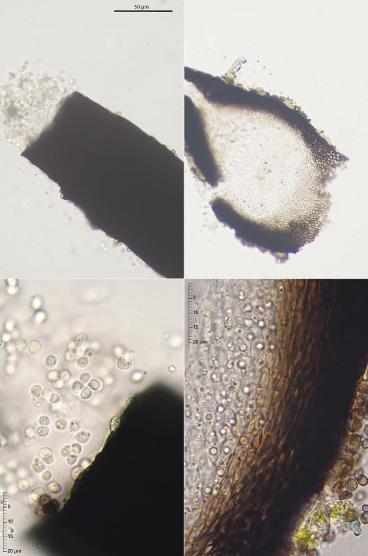 macrostoma