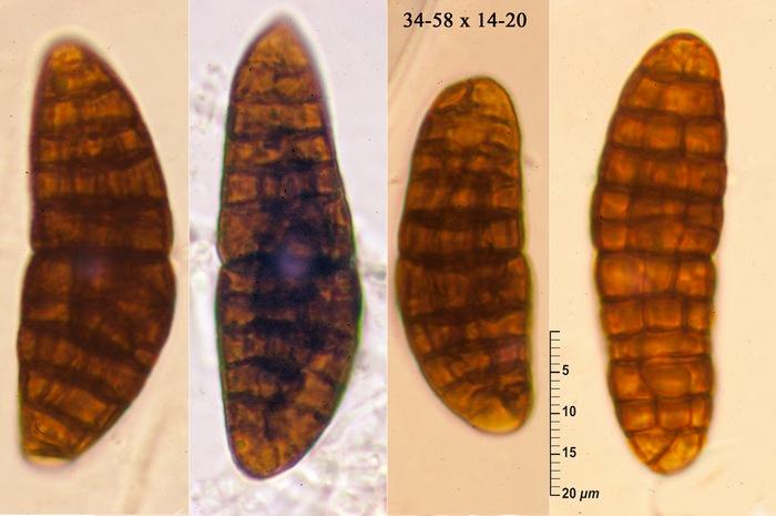 macrostoma