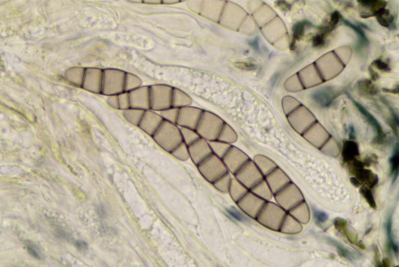 macrostoma