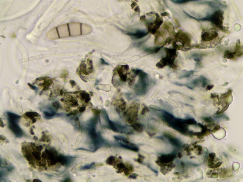 macrostoma