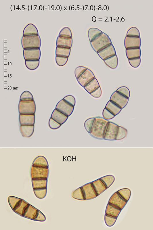 macrostoma