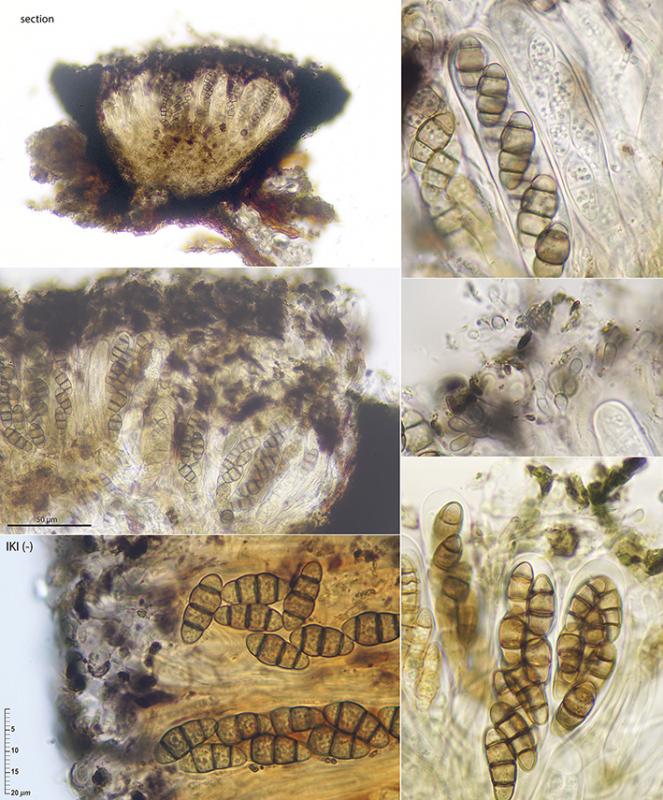 macrostoma