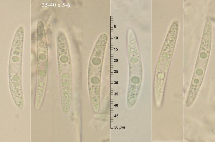 macrostoma