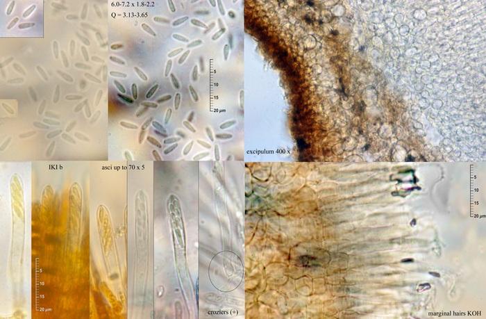 macrostoma