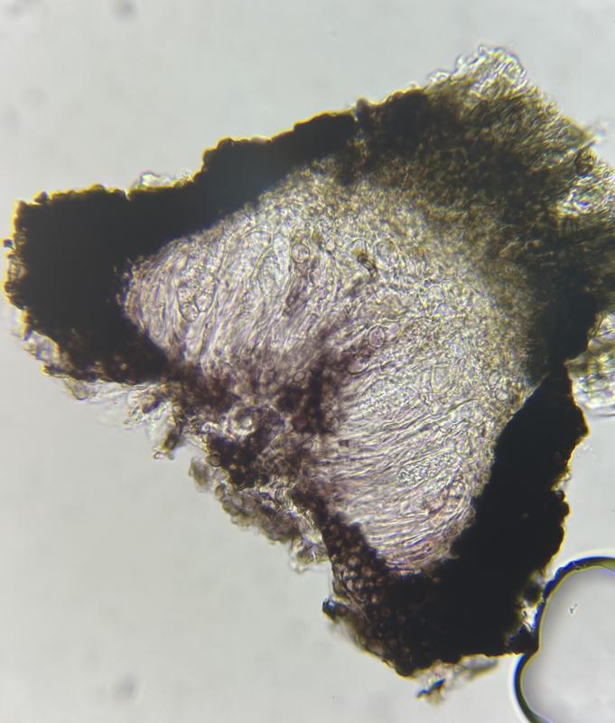 macrostoma