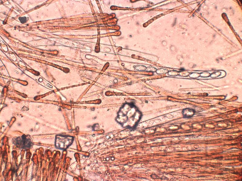 macrostoma
