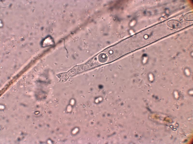 macrostoma