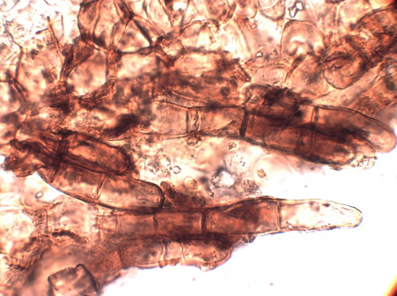 macrostoma