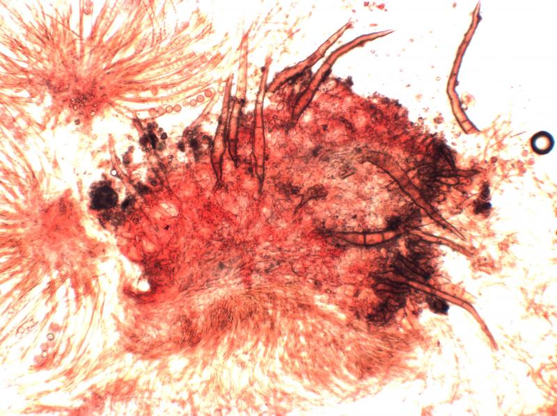 macrostoma