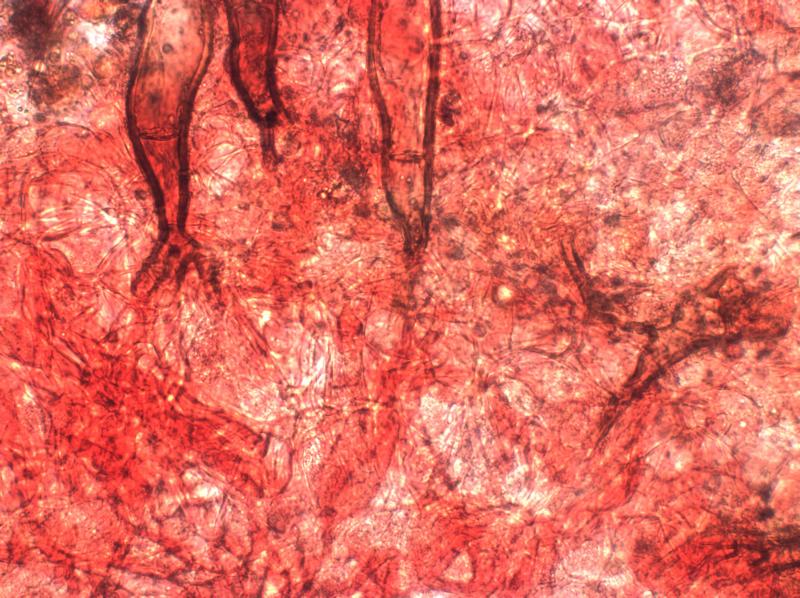 macrostoma