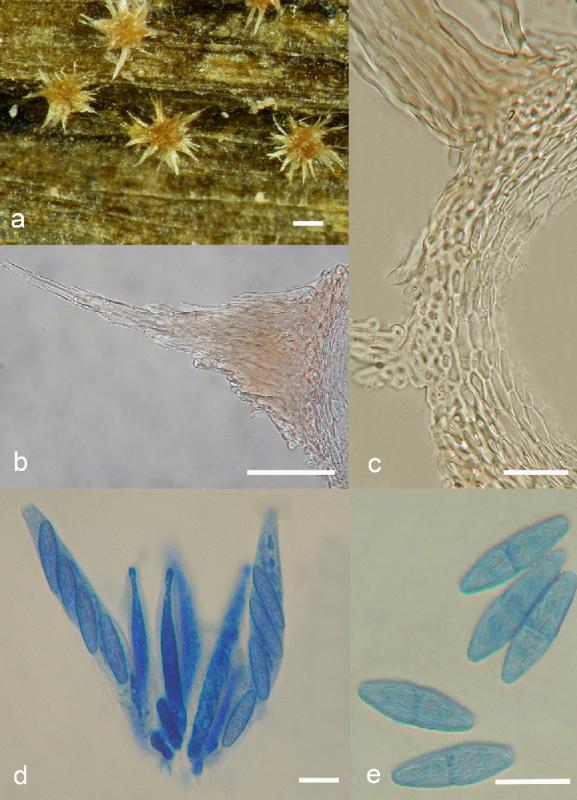 macrostoma