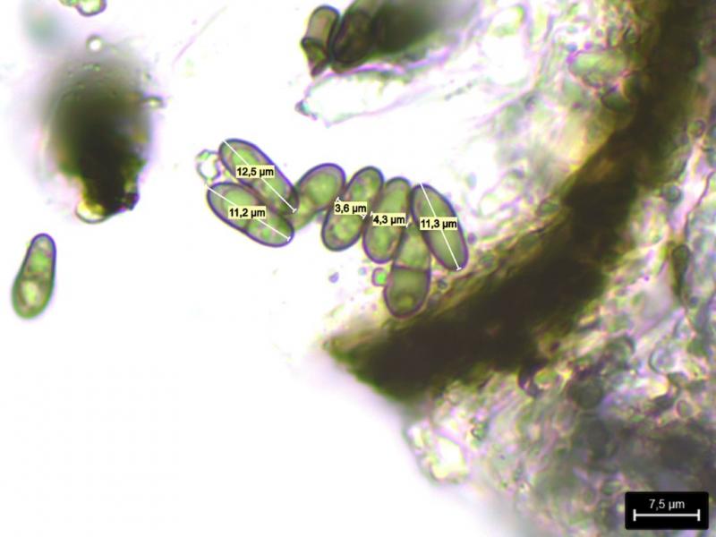 macrostoma