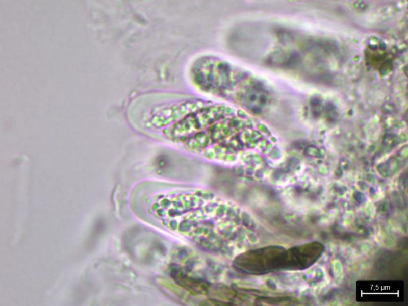 macrostoma