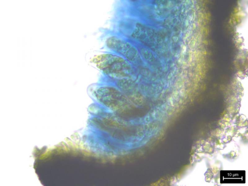 macrostoma
