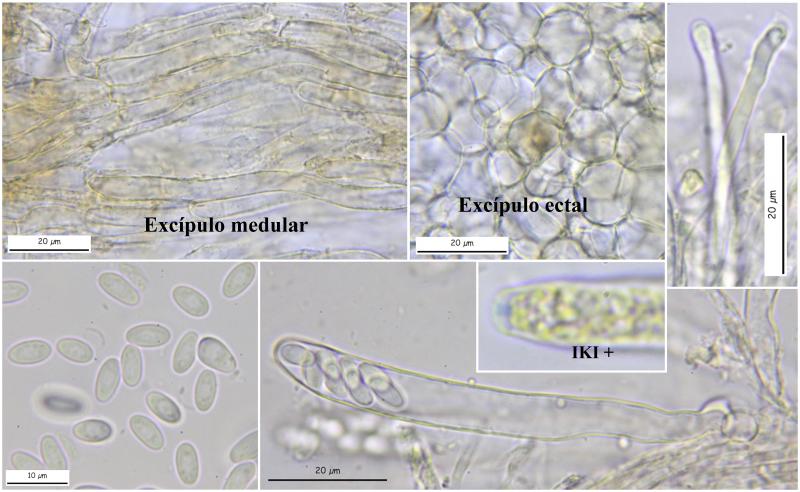 macrostoma