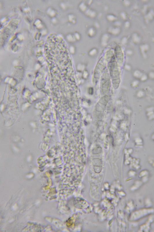 macrostoma