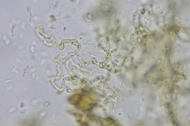 macrostoma