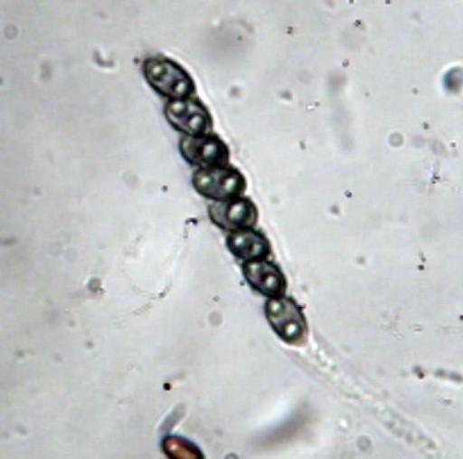 macrostoma