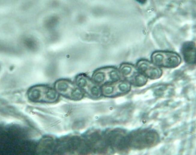macrostoma