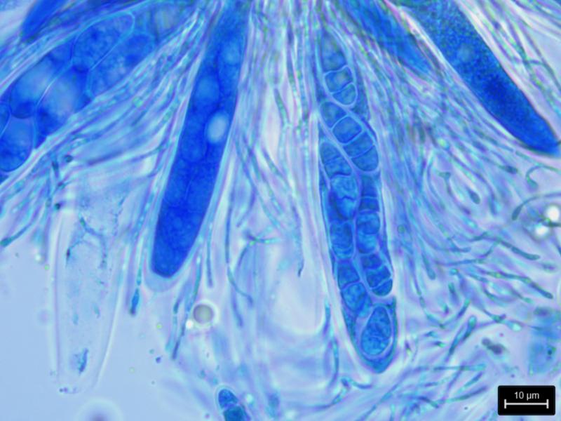 macrostoma