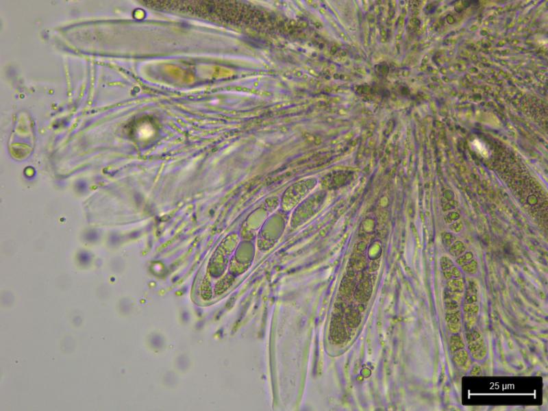 macrostoma