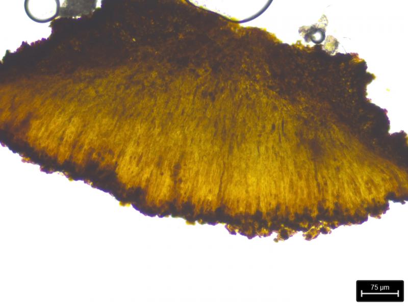 macrostoma