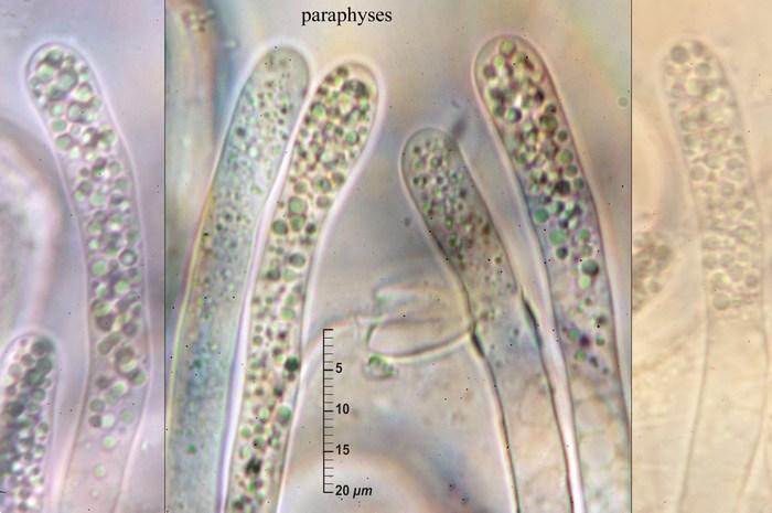 macrostoma
