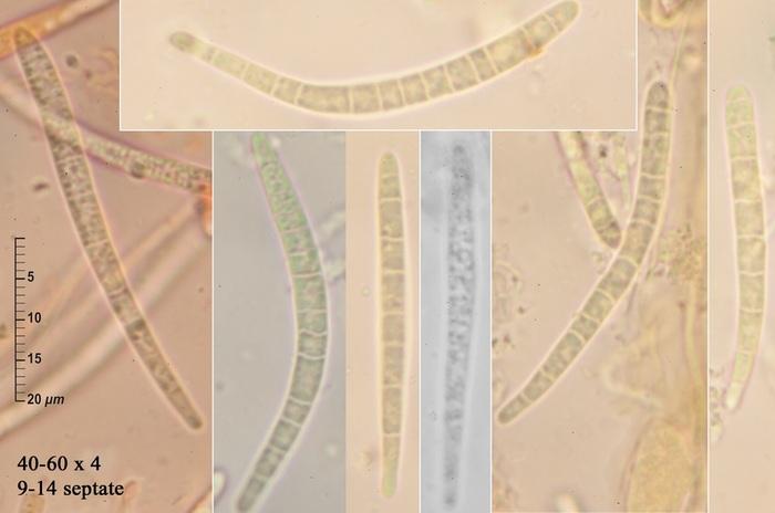 macrostoma