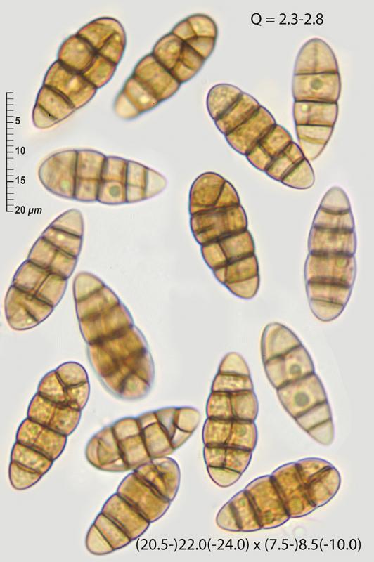 macrostoma