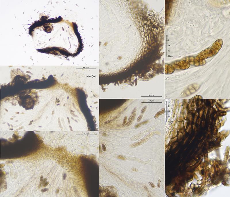 macrostoma