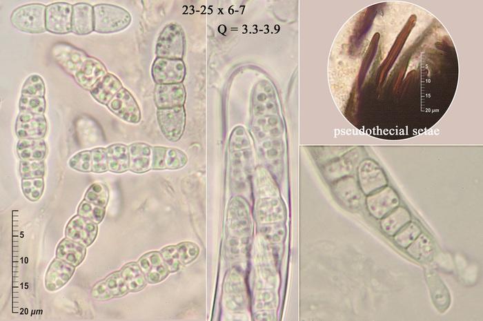 macrostoma