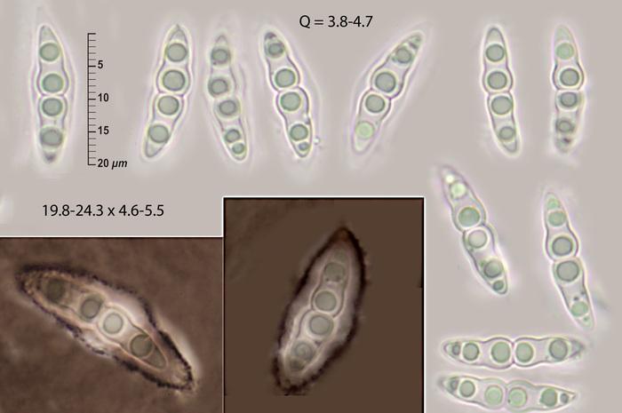 macrostoma