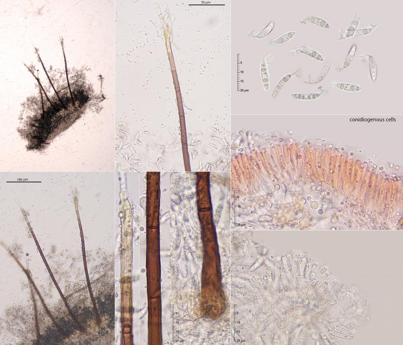 macrostoma